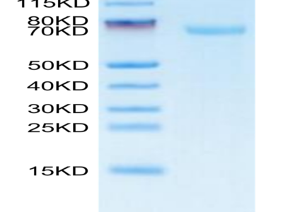 FITC-Labeled Human B7-H3/CD276 Protein (BH7-HM273F)