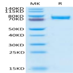 Human B7-H4 Protein (BH7-HM274)