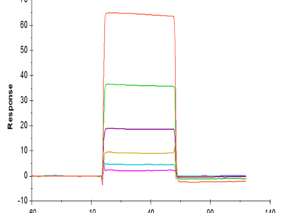 Human B7-H5/Gi24/VISTA Protein (BH7-HM275)