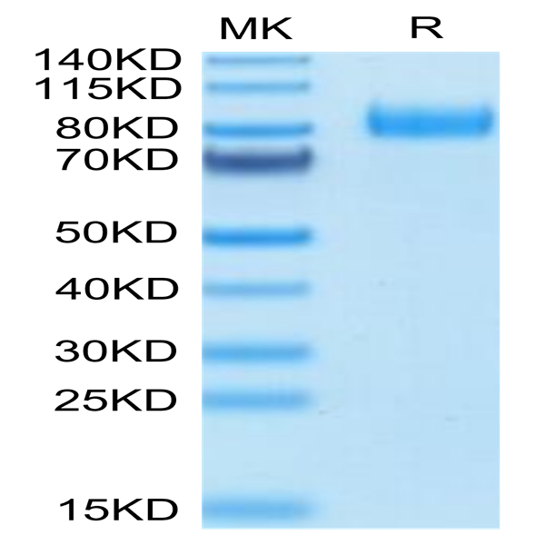 Human B7-H7/HHLA2 Protein (BH7-HM277)