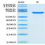 Biotinylated Human Serum Albumin Protein (BSA-HM401B)