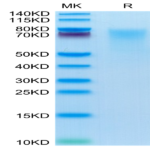 Human BSPII Protein (BSP-HM101)