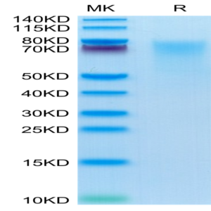 Human BSPII Protein (BSP-HM101)