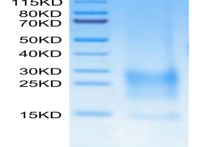 Cynomolgus BST2 Protein (BST-CM202)