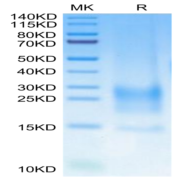 Cynomolgus BST2 Protein (BST-CM202) Cynomolgus BST2 Protein (BST-CM202)