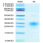 Human BST2 Protein (BST-HM102)