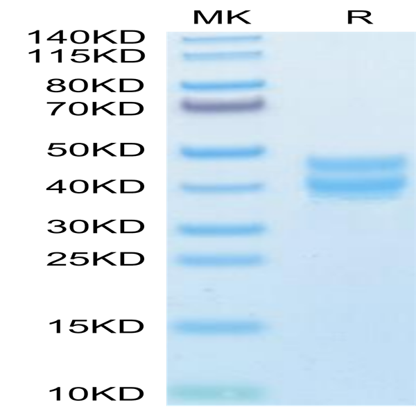 Mouse BST1 Protein (BST-MM101)