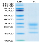 Mouse BST2 Protein (BST-MM102)