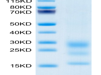 Mouse BST2 Protein (BST-MM102)