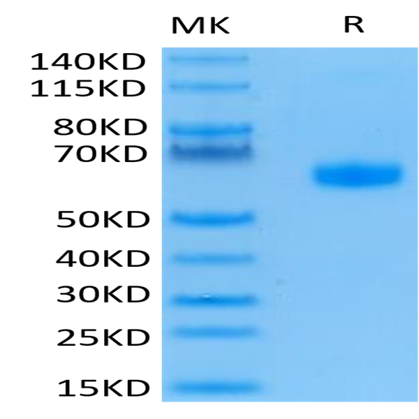 Human BTLA Protein (BTL-HM201)