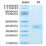 Human BTLA Protein (BTL-HM401)