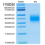 Mouse BTLA Protein (BTL-MM101)