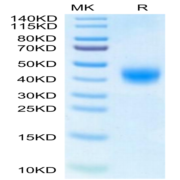 Human BTN2A1 Protein (BTN-HM12A)
