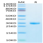 Human BTN3A1/CD277 Protein (BTN-HM1A1)