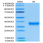 Biotinylated Human BTN1A1/Butyrophilin Protein (BTN-HM4A1B)