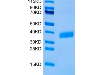 Biotinylated Human APOE3/Apolipoprotein E Protein (Primary Amine Labeling) , APO-HM101B Ushelf