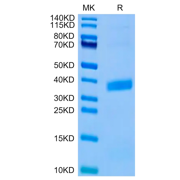 Biotinylated Human APOE3/Apolipoprotein E Protein (Primary Amine Labeling) , APO-HM101B Ushelf