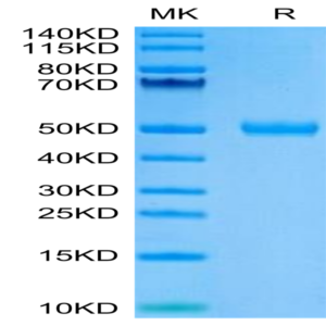 Human CYTL1/C17 Protein (C17-HM217)
