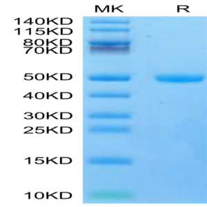 Mouse CYTL1/C17 Protein (C17-MM217)