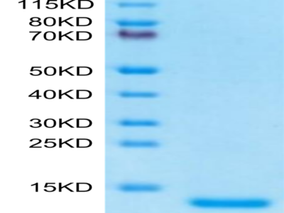 Human Complement C5a Protein (C5A-HE15A)