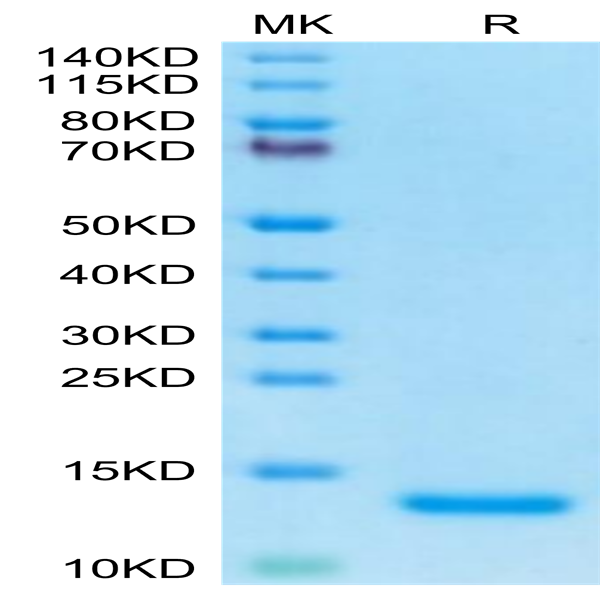 Human Complement C5a Protein (C5A-HE15A) Human Complement C5a Protein (C5A-HE15A)