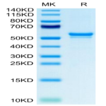 Human CA9/Carbonic Anhydrase IX Protein (CA9-HM401)