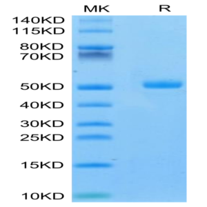 Mouse CA9/Carbonic Anhydrase IX Protein (CA9-MM101)