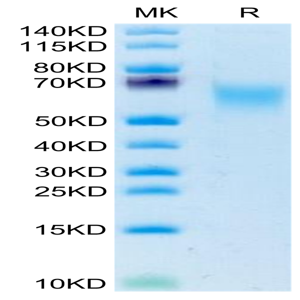 Human CADM1/IGSF4A Protein (CAD-HM101)