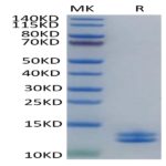 Human Calprotectin (S100A8&S100A9) Protein (CAL-HE101)