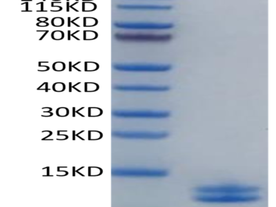 Human Calprotectin (S100A8&S100A9) Protein (CAL-HE101)