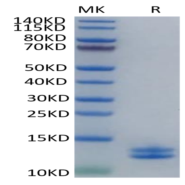 Human Calprotectin (S100A8&S100A9) Protein (CAL-HE101) Human Calprotectin (S100A8&S100A9) Protein (CAL-HE101)