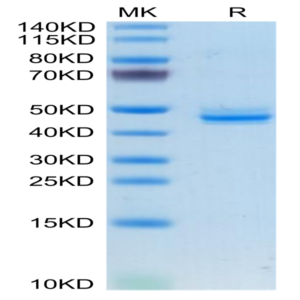 Human CALCA/CGRP Protein (CAL-HM201)