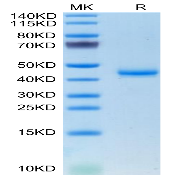Mouse CALCA/CGRP Protein (CAL-MM201)