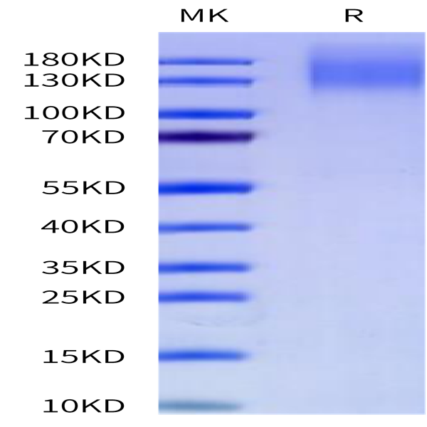 Cynomolgus CEACAM-5/CD66e Protein (CAM-CM105)