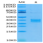 Cynomolgus/Rhesus macaque EpCAM/TROP1 Protein (CAM-CM1EP)