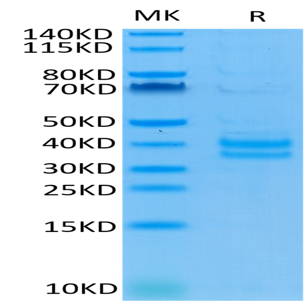 Cynomolgus/Rhesus macaque EpCAM/TROP1 Protein (CAM-CM1EP)