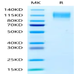 Human CEACAM-5/CD66e Protein (CAM-HM105)