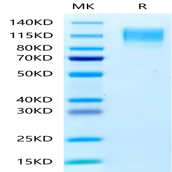 Human CEACAM-5/CD66e Protein (CAM-HM105)