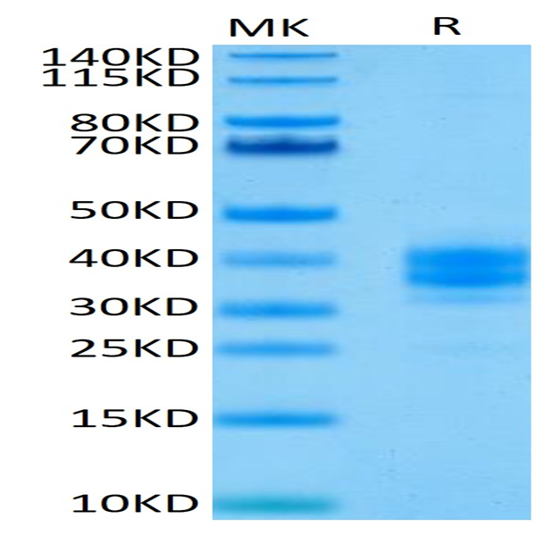 Human EpCAM/TROP1 Protein (CAM-HM1EP)