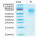 Human CEACAM-6/CD66c Protein (CAM-HM406)