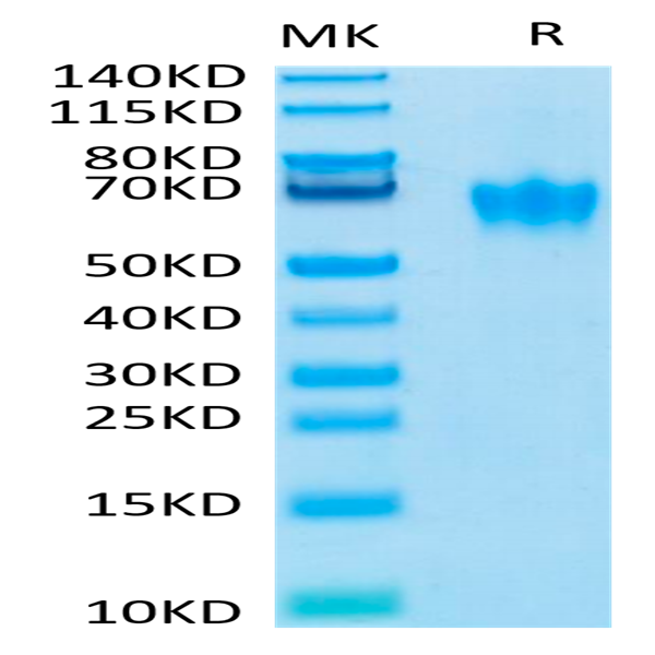 Biotinylated Human CEACAM-6/CD66c Protein (CAM-HM406B)
