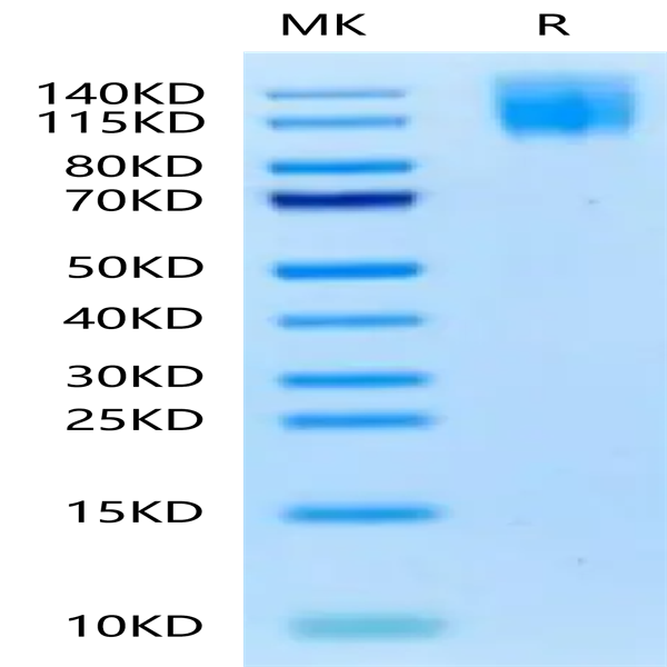 Biotinylated Human CEACAM-5/CD66e Protein (CAM-HM415B)