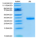 Biotinylated Human EpCAM/TROP1 Protein (CAM-HM4EPB)