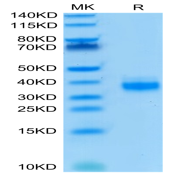 Biotinylated Human EpCAM/TROP1 Protein (CAM-HM4EPB)