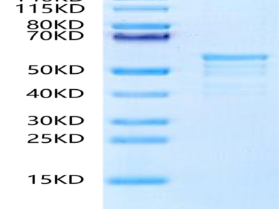 Biotinylated Human CKAP4 Protein (Primary Amine Labeling) (CAP-HE1P4B)