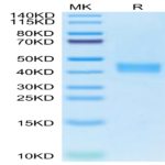 Human carbonic anhydrase XII Protein (CAS-HM112)
