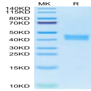 Human carbonic anhydrase XII Protein (CAS-HM112)
