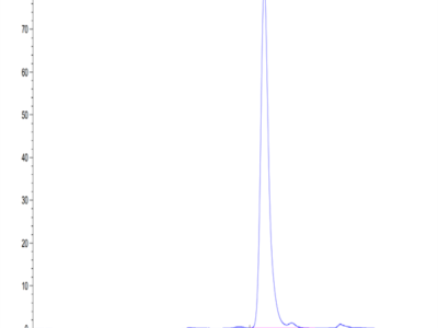 Human Complement Component C2 Protein (CC2-HM101)