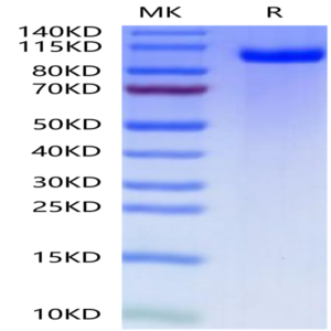 Mouse PTK7/CCK4 Protein (CCK-MM104)