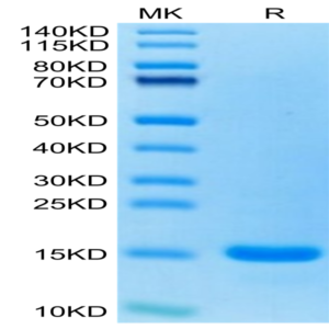 Human CCL7/MCP3 Protein (CCL-HE007)